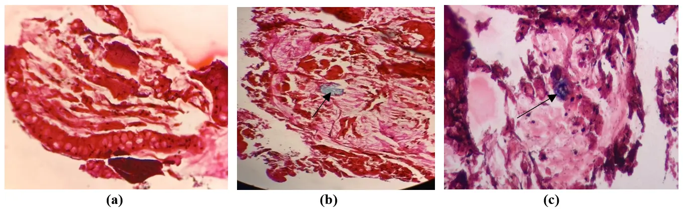 Figure_21_1