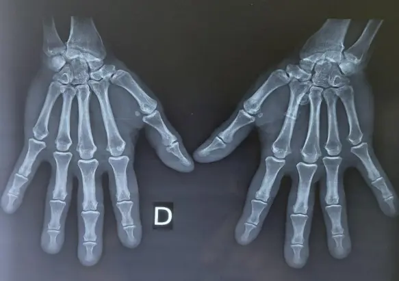 Figure_3_1